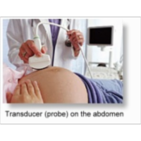 Obstetric Ultrasound - A Comprehensive Guide icon