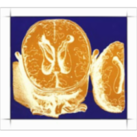 Anatomy Atlases icon