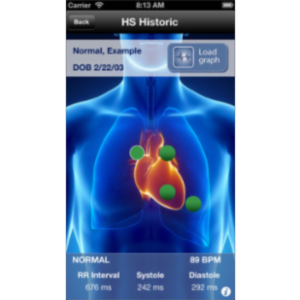 SensiCardiac App for iOS