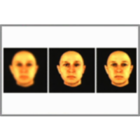 Vision: Challenges and Prospects