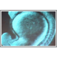 Form from the Formless: The Awesome Power of the Embryo icon