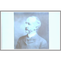 Lecture 19 - Tuberculosis (II): After Robert Koch icon